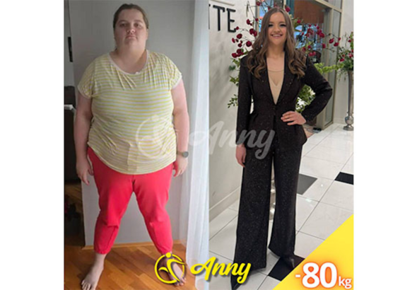 VIDEO: Nevjerojatna transformacija: Matea smršala 80 kilograma i postala inspiracija mnogima